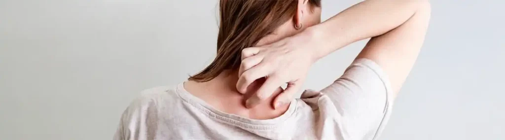 ¿Puede el estrés y psoriasis estar relacionados el uno del otro?