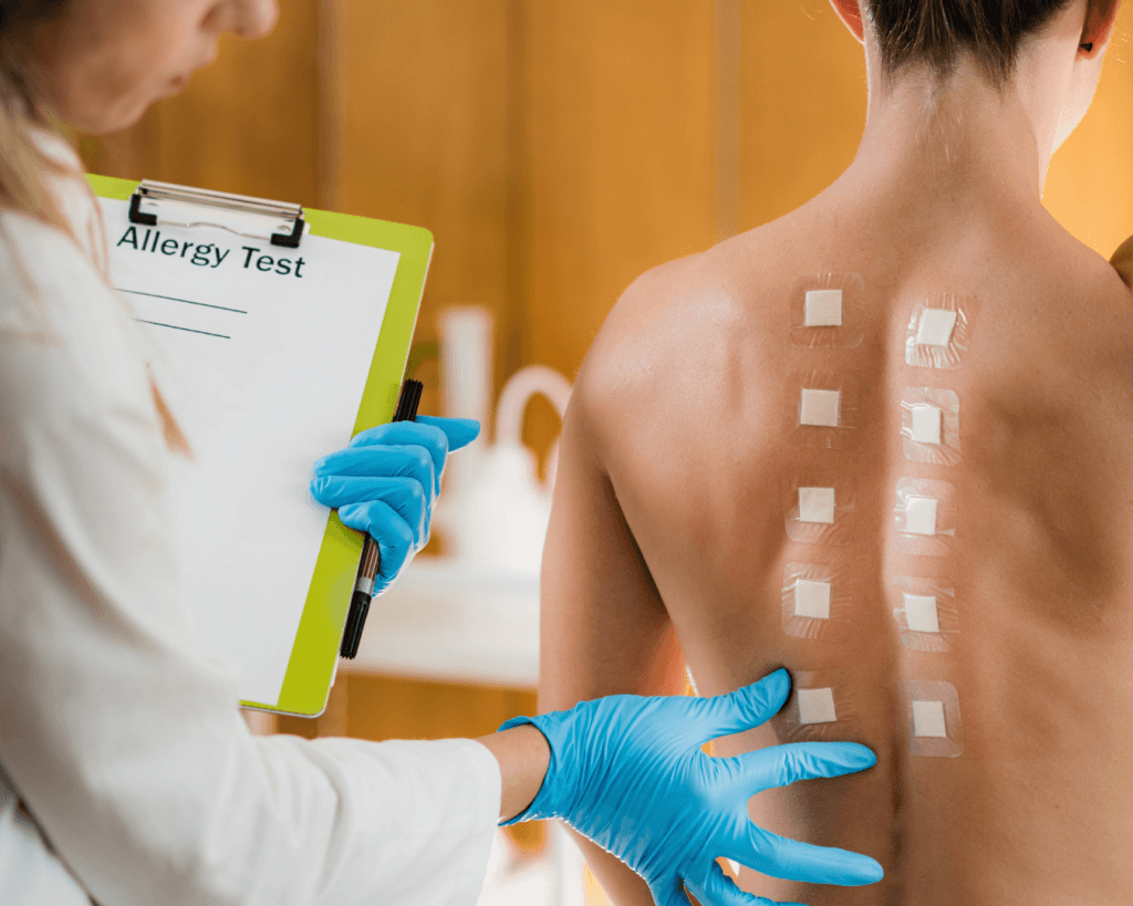 inmunólogo tomando exámen de alergia en espalda